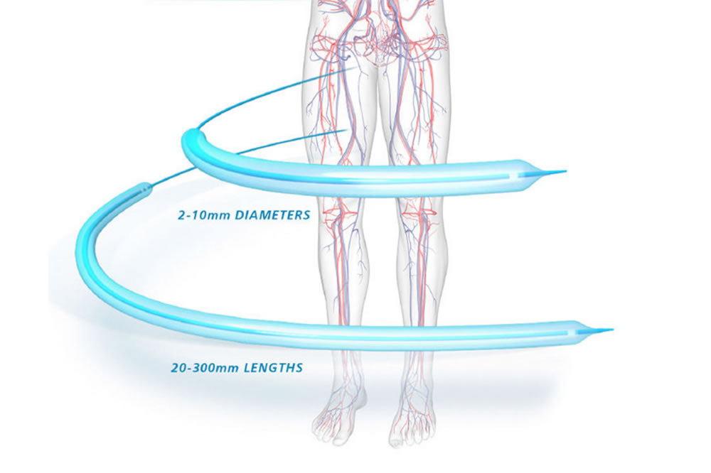 SABER™-0.018-PTA-Dilatation-Catheter.jpg